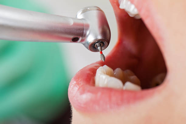 Best Orthodontic Emergency Dentist in Grass Lake, MI